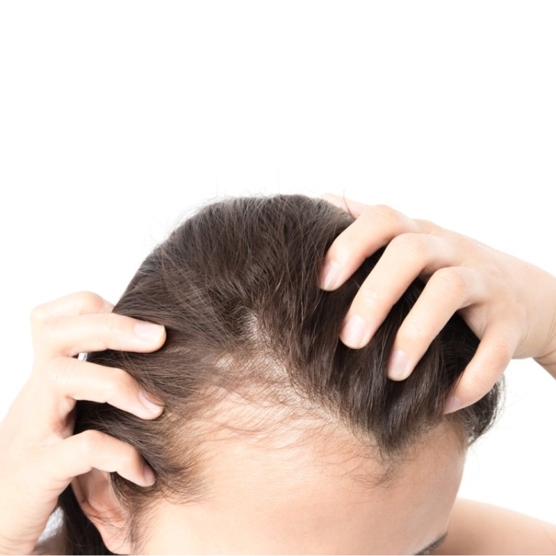 šampon proti izpadanju las